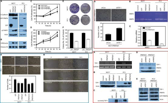 PRMT6 overexpression upregulates TSP-1 and downregulates MMPs: Its implication in motility and invasion.