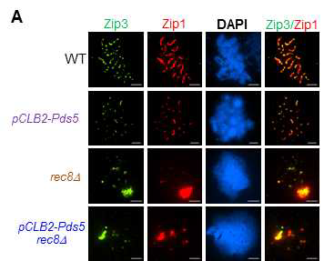 야생형, pCLB2-Pds5, rec8Δ, 그리고 pCLB2-Pds5, rec8Δ에서 Zip3 단백질과 Zip1 단백질, DAPI의 대표 이 미지.