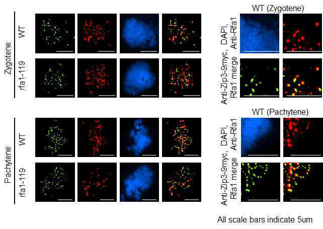 야생형과 rfa1-119 효모에서 감수분열의 Leptotene, Zygotene, Pachytene 각 단계에서 Rfa1 단백질과 Zip3 단백질의 상 호 위치를 본 현미경 사진.