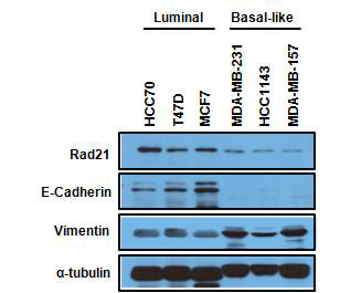 Epithelial/Mesenchymal 유방암 세포주에서의 Rad21 protein 발현 관찰.