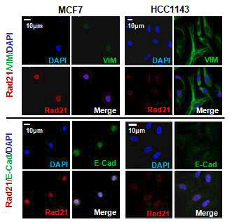 IFA assay를 통한 Rad21 발현과 EMT마커 발현과의 상관관계 규명.