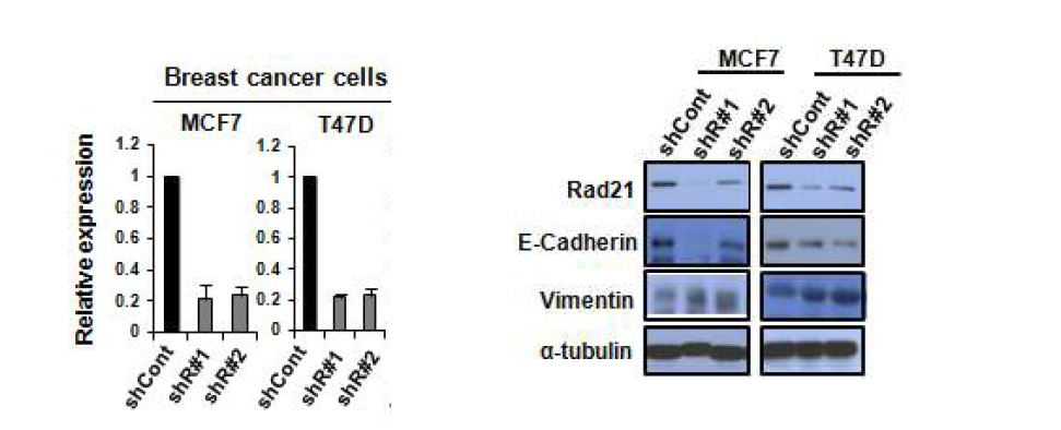 Epithelial 유방암 세포주 MCF7과 T47D에 Rad21-Knockdown후, EMT marker 증가 확인