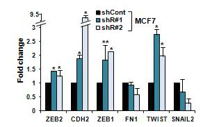 Rad21-knocdown MCF7 세포주에 서의 EMT marker 발현 증가 확인.