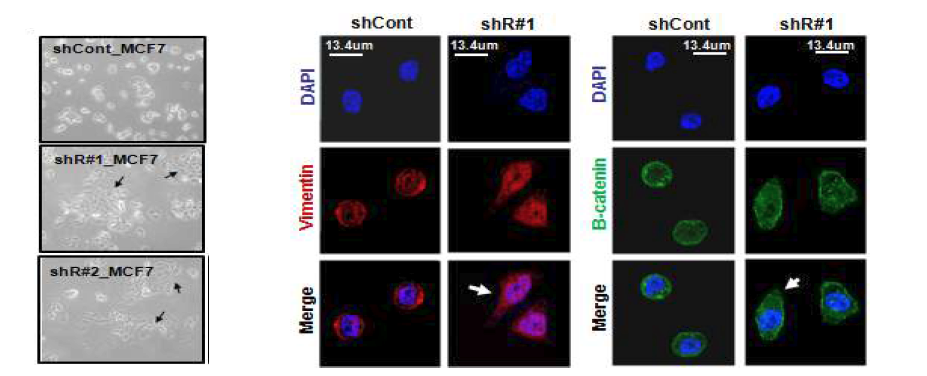 Rad21-knockdown MCF7 세포주에서의 fibroblast-like shape 변화 확인 (왼쪽) 및 EMT marker Vimentin과 B-catenin의 세포 reorganization (오 른쪽)