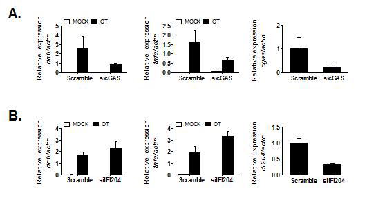 siRNA를 이용한 cGAS 및 IFI204 knockdown MEF에서 IFN-b와 TNF-a의 발현 분석