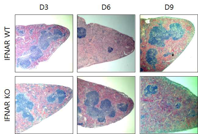 쯔쯔가무시균이 감염된 IFNAR WT 과 KO 마우스에서 비장 follicle 구조의 변환