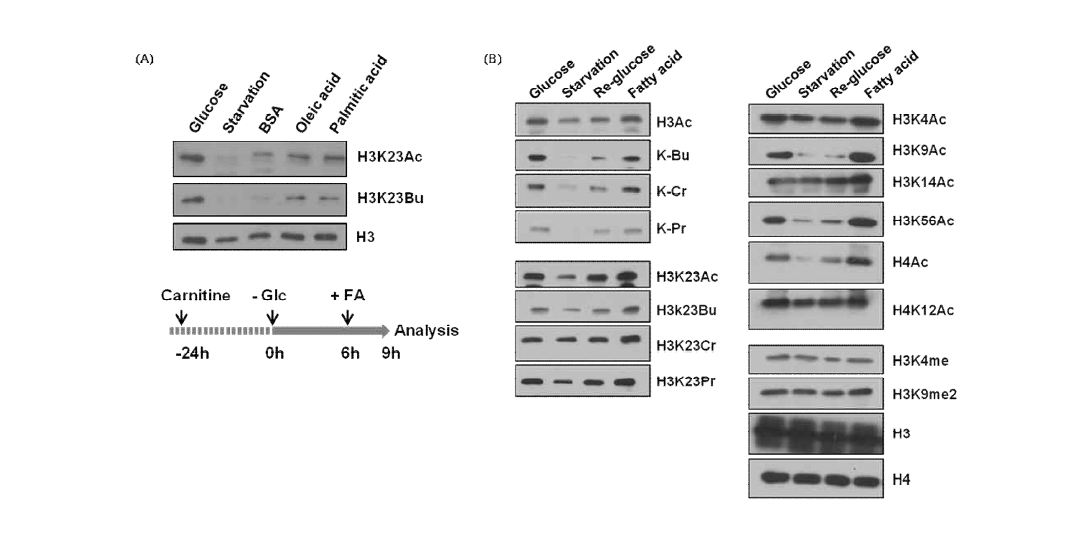 (A)C2C12 Myotube cell에서 fatty acid feed시 histone modification 변화 (B)HepG2 cell에서 glucose re-feed 및 fatty acid feed시 histone modification 변화