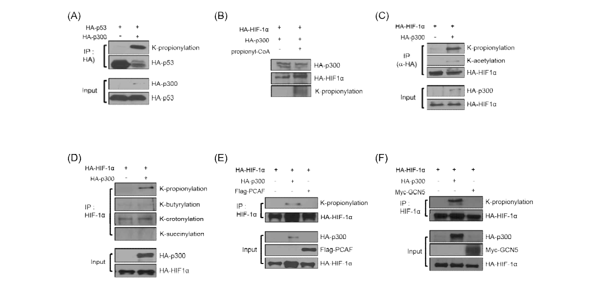 (A) 293T 세포에서 p300에 의한 p53의 propionylation (B) Assay를 통한 HIF-1α의 propionylation (C) p300에 의한 HIF-1α의 propionyalation (D) HIF-1α에 존재하는 여러 acylation (E), (F) p300을 제외한 PCAF 및 GCN5에 의한 propionylation 확인