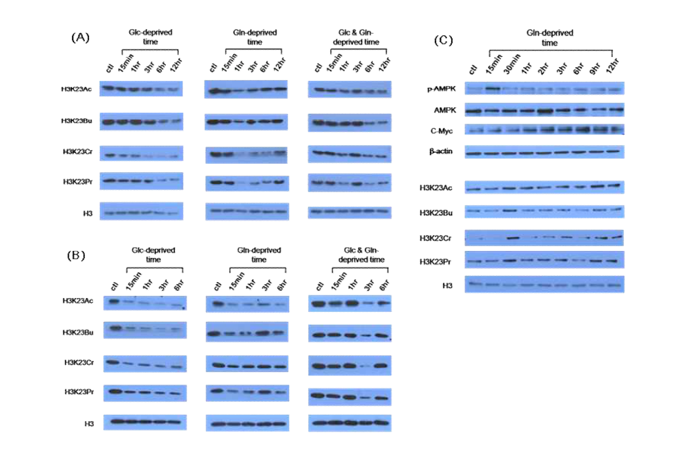 (A)유방암 세포주(MCF7)에서 Glucose와 glutamine 부족에 기인한 히스톤 코드변화 확인 (B)유방암 세포주(MDA-MB231)에서 Glucose와 glutamine 부족에 기인한 히스톤 코드변화 확인(C)유방암 세포주(MCF7)에서 glutamine 부족에 기인한 히스톤 코드변화, AMPK활성화 및 MYC protein 변화 확인