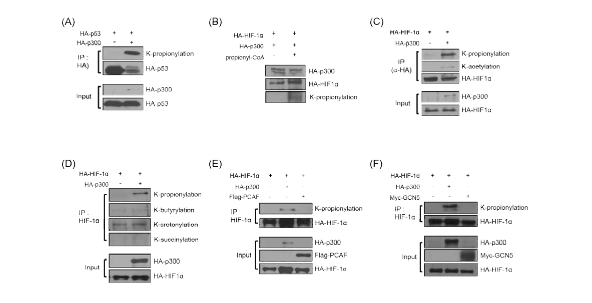 (A) 293T 세포에서 p300에 의한 p53의 propionylation (B) Assay를 통한 HIF-1α의 propionylation (C) p300에 의한 HIF-1α의 propionyalation (D) HIF-1α에 존재하는 여러 acylation (E), (F) p300을 제외한 PCAF 및 GCN5에 의한 propionylation 확인