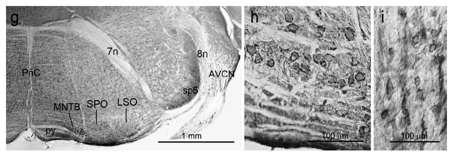 뇌줄기에서 ANO1 발현(g). 능형섬유체(g), 배쪽청각핵(i).