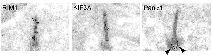 RIM1, KIR3A, 그리고 Panα1의 immunogold electron micrographs