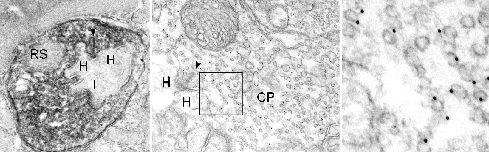 ANO1 미세구조적 위치를 확인하고자 수행한 conventional immunoelectron micrographs(첫번째) 와 immunogold immunoelectron micrographs(두번째). 세번째는 두번째 사진의 사각형 영역을 확대한 것