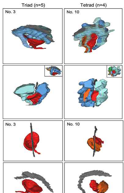 막대세포에 형성된 두 종류(triad, tetrad)의 리본시냅스의 전형적인 예