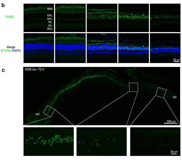 Blue-LED 유도 망막변성 모델의 TUNEL 염색. (B) 시간에 따른 변화 (C) 부위별 차이