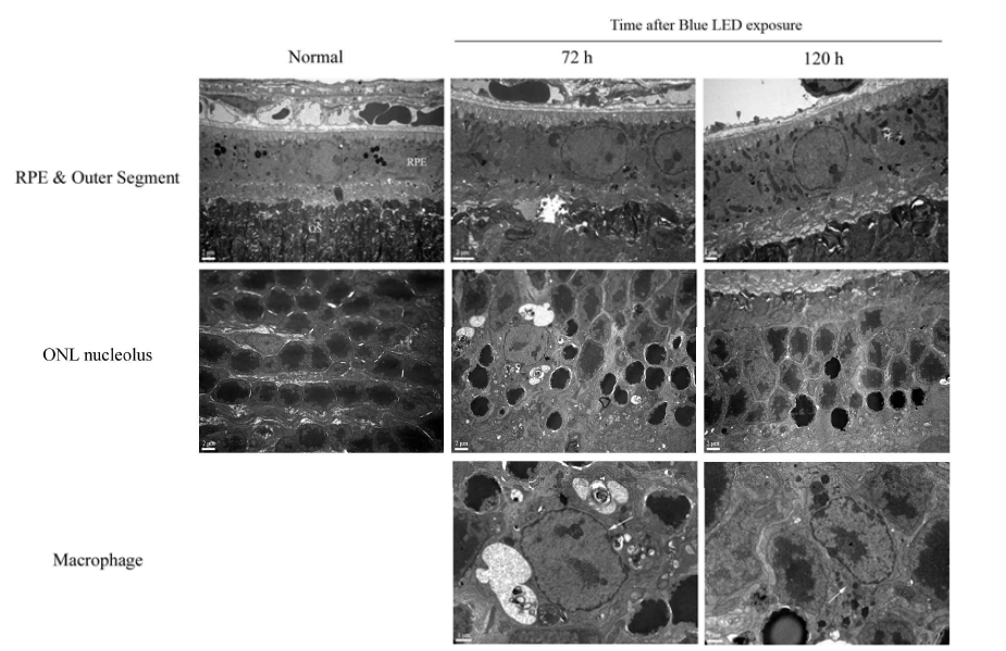 2000 lux blue-LED로 유도된 망막조직의 electron micrographs (1)