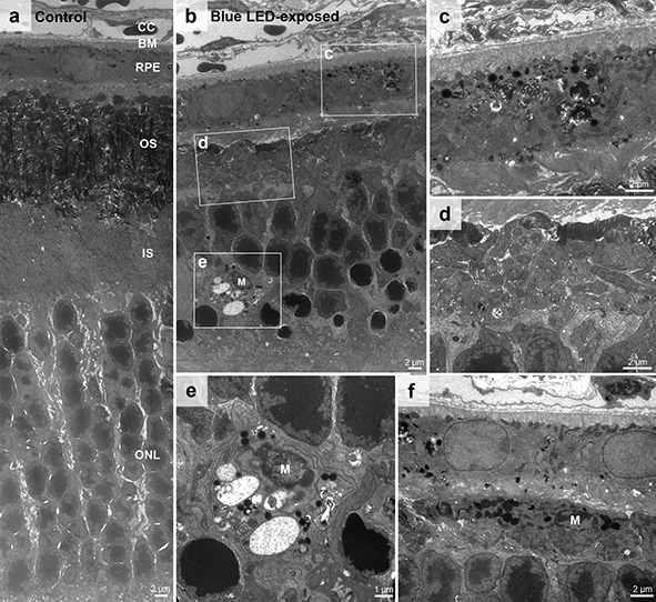 2000 lux blue-LED로 유도된 망막조직의 electron micrographs (2)