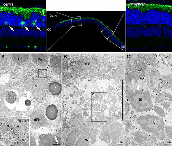 망막변성 유도 후 24시간 군의 osteopontin 발현 (위) 중심부 특이 발현 (아래) 전자현미경 소견