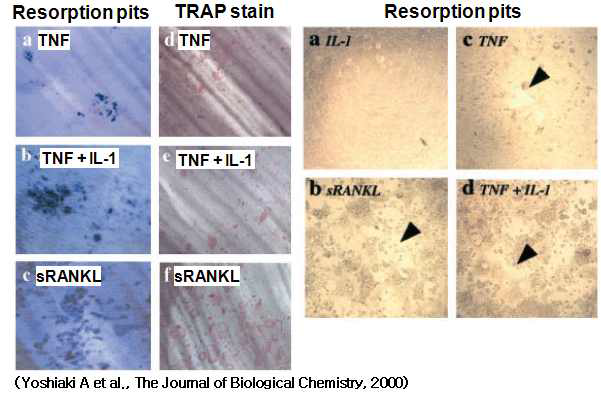 TNF-α가 파골세포 기능에 미치는 영향