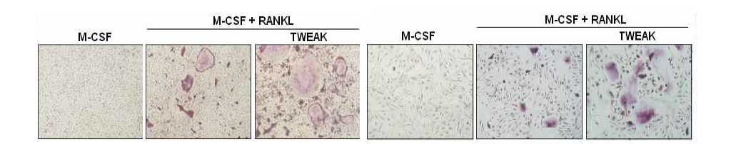 TWEAK을 통한 마우스(좌)와 사람(우) 파골세포 분화 촉진