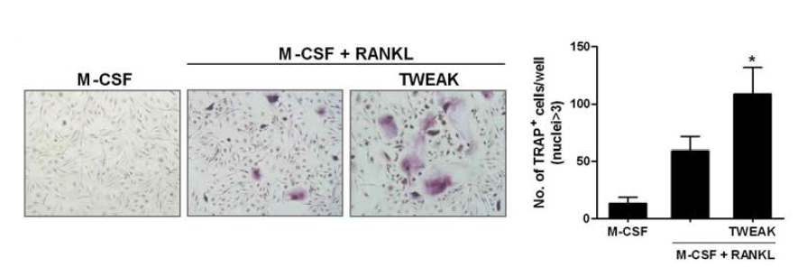 TWEAK을 통한 사람 파골세포 분화 촉진