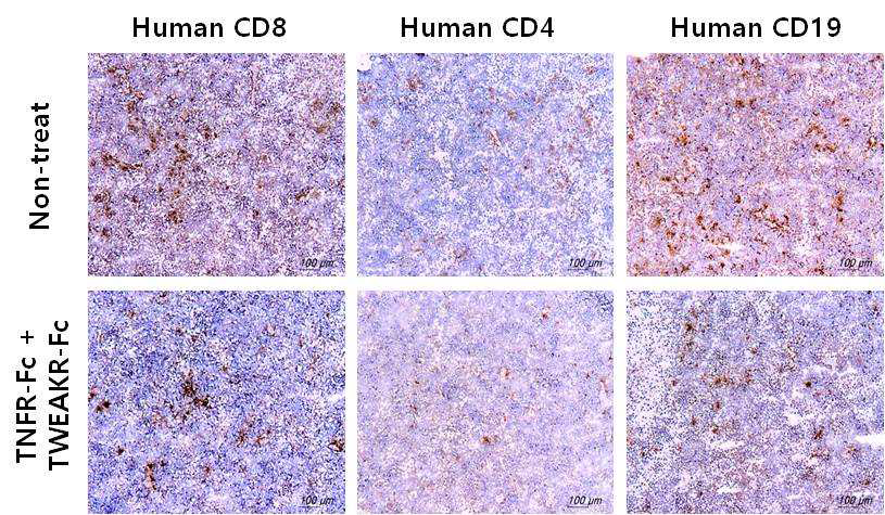 humanized 류마티스관절염 마우스 비장 내 침윤된 human 세포 조사 (면역조직화학염색법)