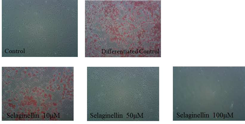 대조군, 분화대조군, selaginellin 의 농도별 3T3-L1 사진