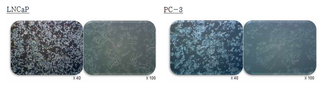 LNCaP 포주와 PC-3 세포주의 현미경 사진