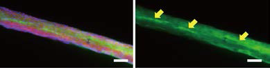 Ultra 3D 지지체에서의 근아세포 분화 (Green : MHC, Red : actin, Blue : DAPI, scale bar : 200 μm)