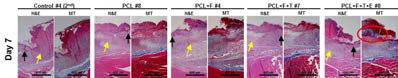 지지체 이식 7일 후 상처 부위의 histology, MT stainning 결과 상처 윗 부분에 콜라겐이 생성되는 추가 부분을 확인 할 수 있음 (Red Circle)