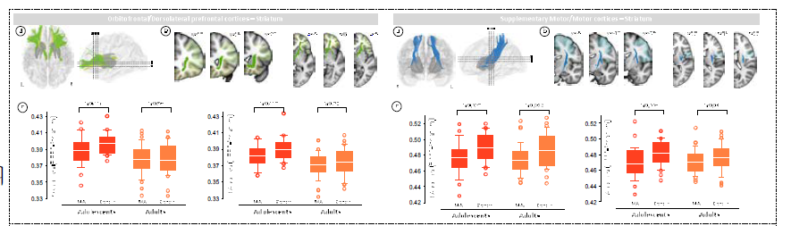 정상 청소년군과 약물 사용 청소년군의 fronto-striatal/motor-striatal 연결성의 변화(현재 국제 학술지 투고 준비 중임).