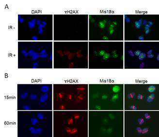 DNA 손상 시 Mis18α의 세포내 위치 분석.