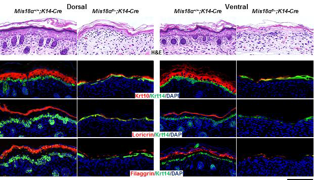 정상생쥐와 keratinocyte-특이적 Mis18α 결손생쥐에서 상피층의 층별 마커 단백질에 대한 면역염색을 통한 층분화 분 석.