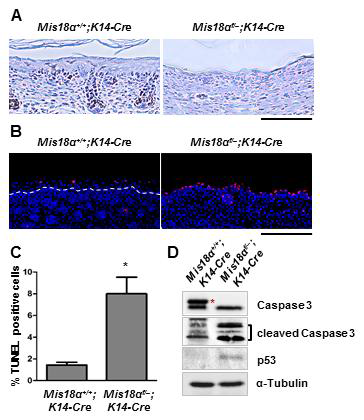 정상생쥐와 keratinocyte-특이적 Mis18α 결손생쥐에서 상피층의 세포분열 및 세포사멸 분석.