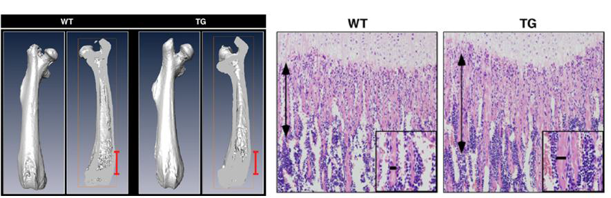 조골세포 특이적 Ang1 과다발현 동물모델에 서의 골 재생 효과.