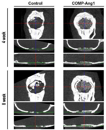 두개골 결손모델에 대한 COMP-Ang1의 처리와 그에 따른 신생골 재생 효과에 대한 micro-CT 분석.