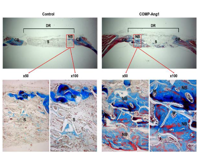 H & E 염색을 통한 COMP-Ang1 유도성 신생골 형성과 골 재생촉진 확인.