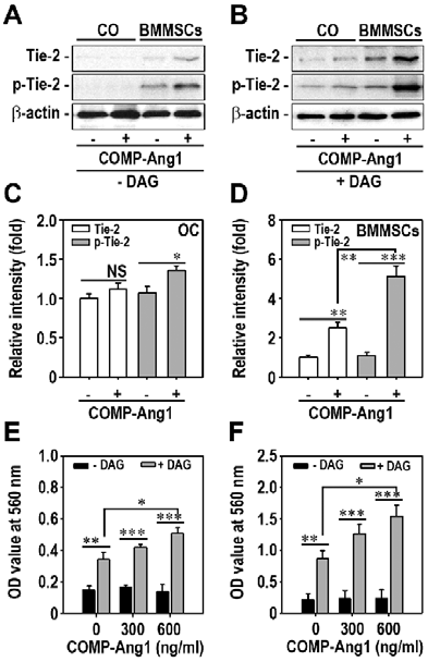 조골세포와 골수유래줄기세포에 대한 재조합 COMP-Ang1의 처리가 Tie-2인산화 및 골세포분화에 미치는 효과분석.
