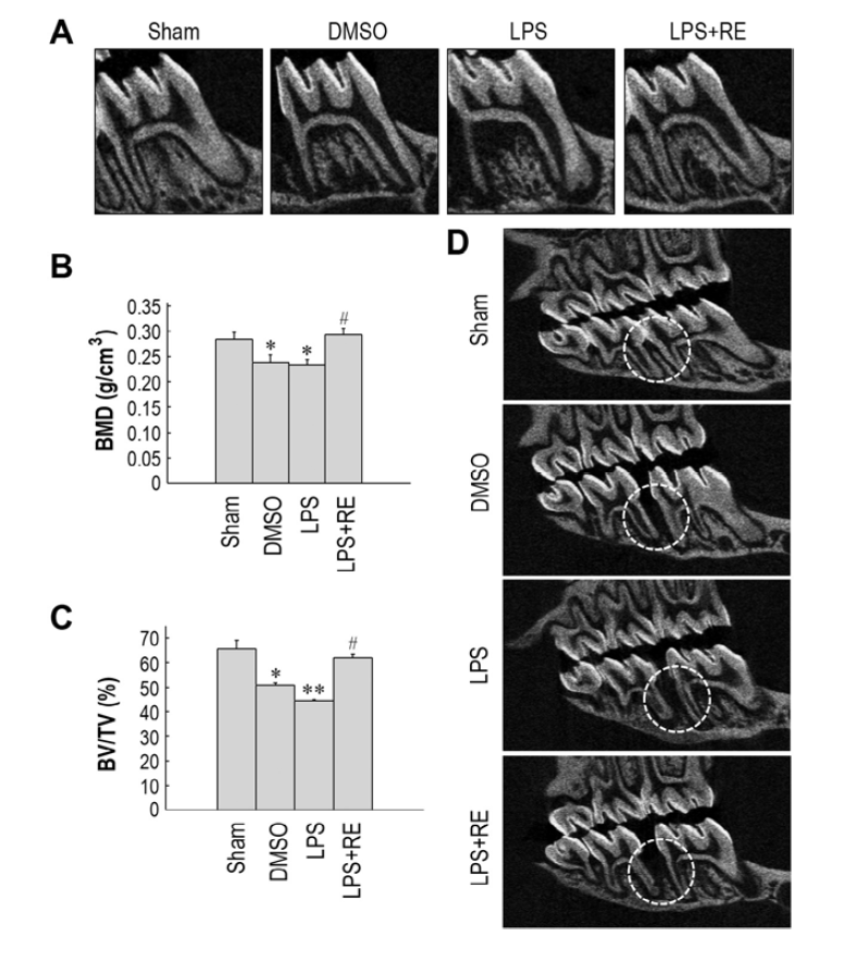 Supplementation with resveratrol protects rats against LPS-induced bone loss in the periodontium.