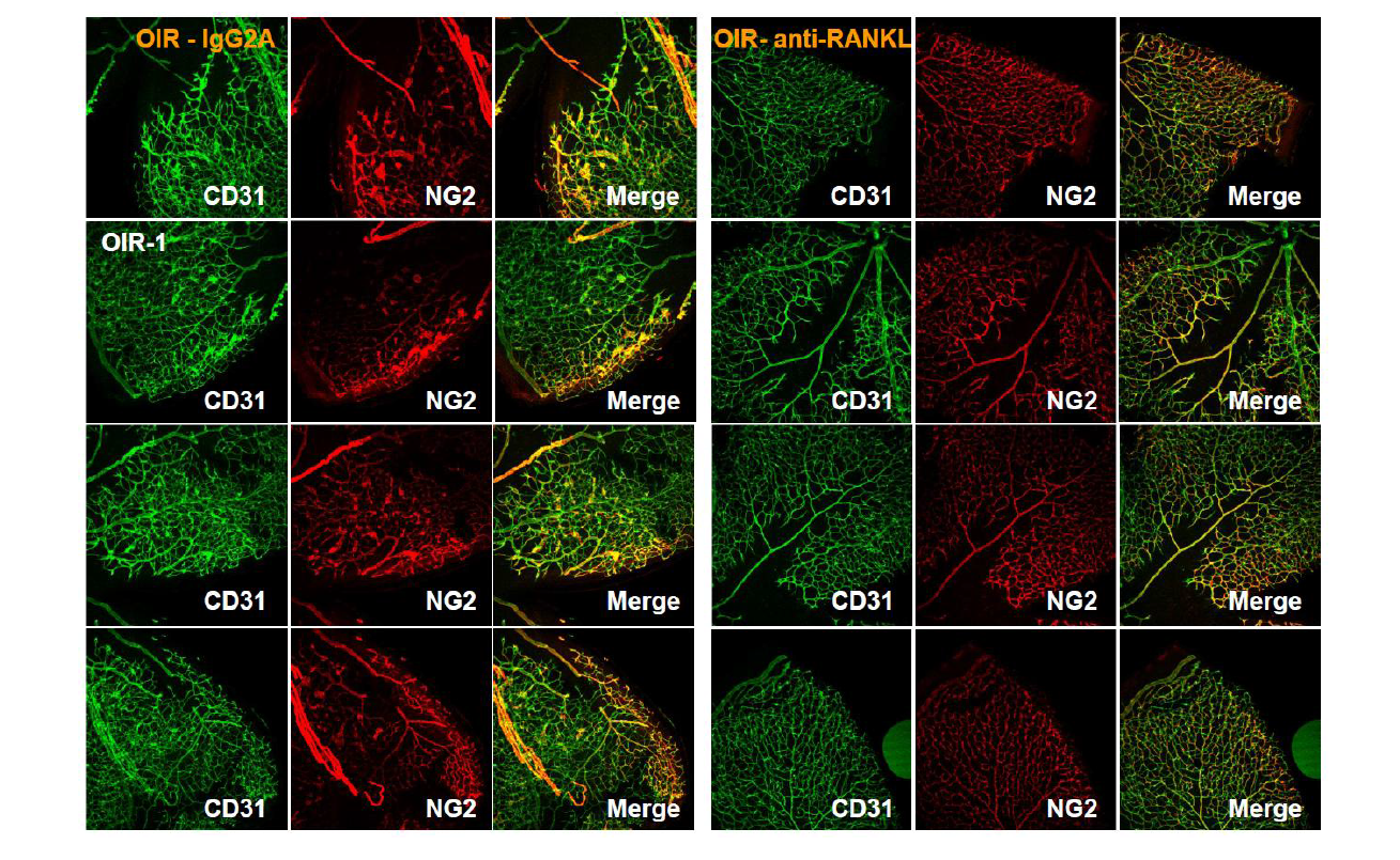 산소-유도 망막병증 모델쥐의 유리강내로 주입한 RANKL 단일클론항체의 신생혈관 CD31과 α SMA 발현 억제 효과.