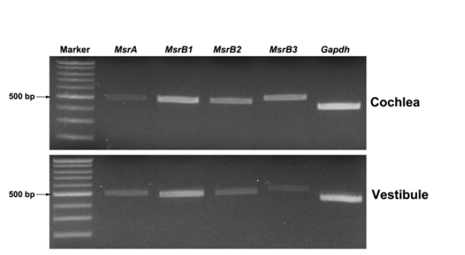 생후 3주된 마우스의 조직에서 각 조직별 Inner ear에서의 발현양상.