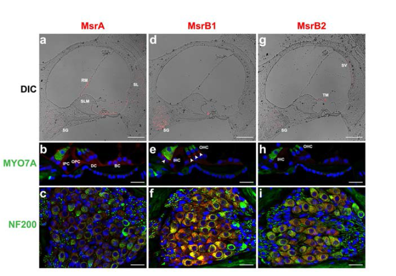 면역형광염색법을 이용한 달팽이관에서의 MsrA, MsrB1, MsrB2의 발현양상.