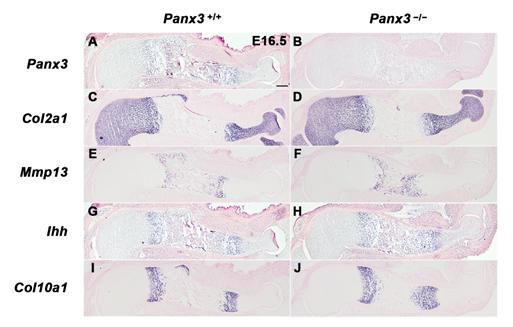 Panx3 마우스에서 말기 연골세포로의 비정상적인 분화.