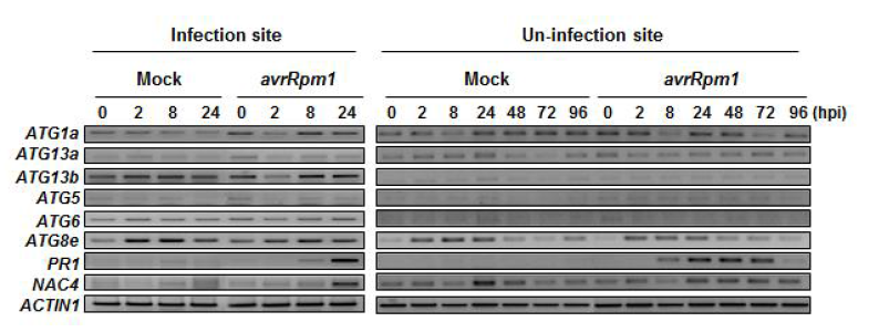 Pst DC3000 (avrRpm1) 주입된(좌) 및 주입되지 않은(우) 식물체에서 ATG13 및 autophagosome 형성 유전자들의 발현 분석