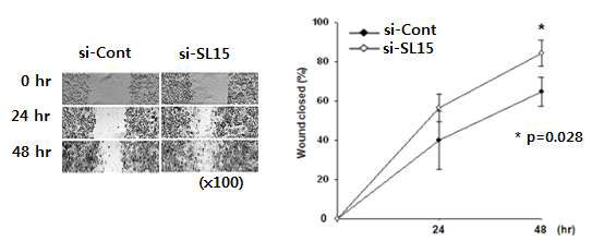 SL-15 억제에 의한 대장암 세포주의 wound healing 확인