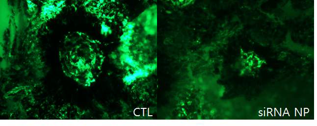 Laser로 유발된 CNV 이미지와 siRNA NP가 주입된 군의 CNV 이미지