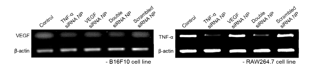 VEGF, TNF-α mRNA inhibition 검증을 위한 젤 전기영동 이미지