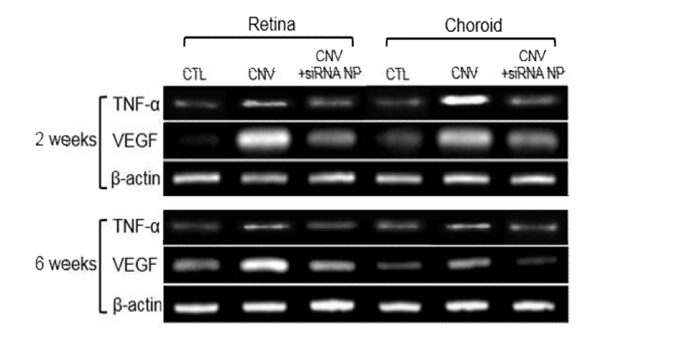 2주차, 6주차 mouse CNV 모델에서 VEGF, TNF-α mRNA inhibition 검증을 위한 젤 전기영동 이미지