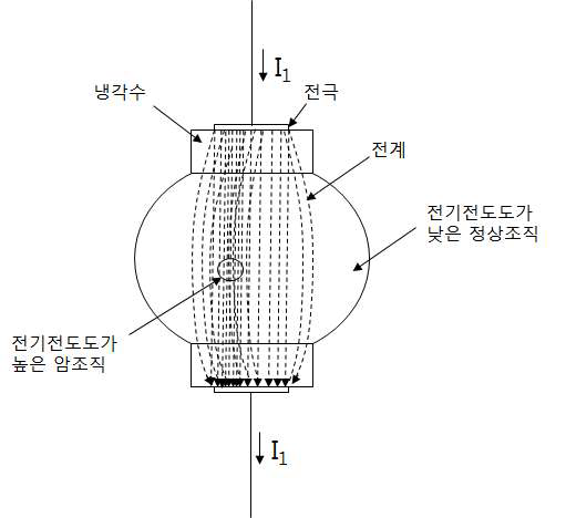 고주파 전류 인가 시스템의 원리를 간략적으로 보여주는 그림