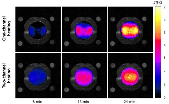 실제 인체 모방 팬텀에 8 분, 16 분, 24 분동안 한 방향 고주파 가열(One channel RF heating)과 두 방향 고주파 가열(Two channel RF heating)을 한 온도영상 모습.